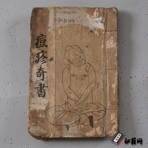 《痘疹奇書》
